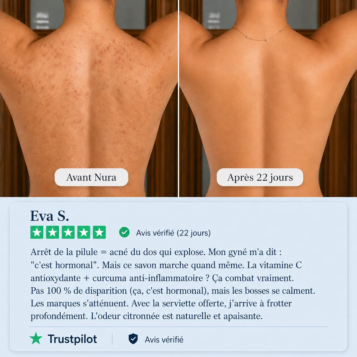 Savon anti-imperfections Nura – L’anti-acné du dos qui te rend ta liberté