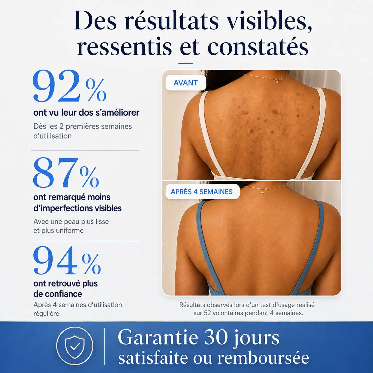 Savon anti-imperfections Nura – L’anti-acné du dos qui te rend ta liberté
